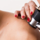 skin cancer